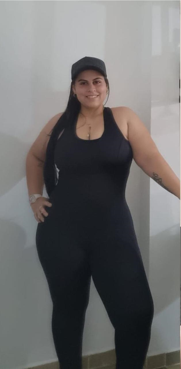 Paciente antes del tratamiento de cirugía bariátrica